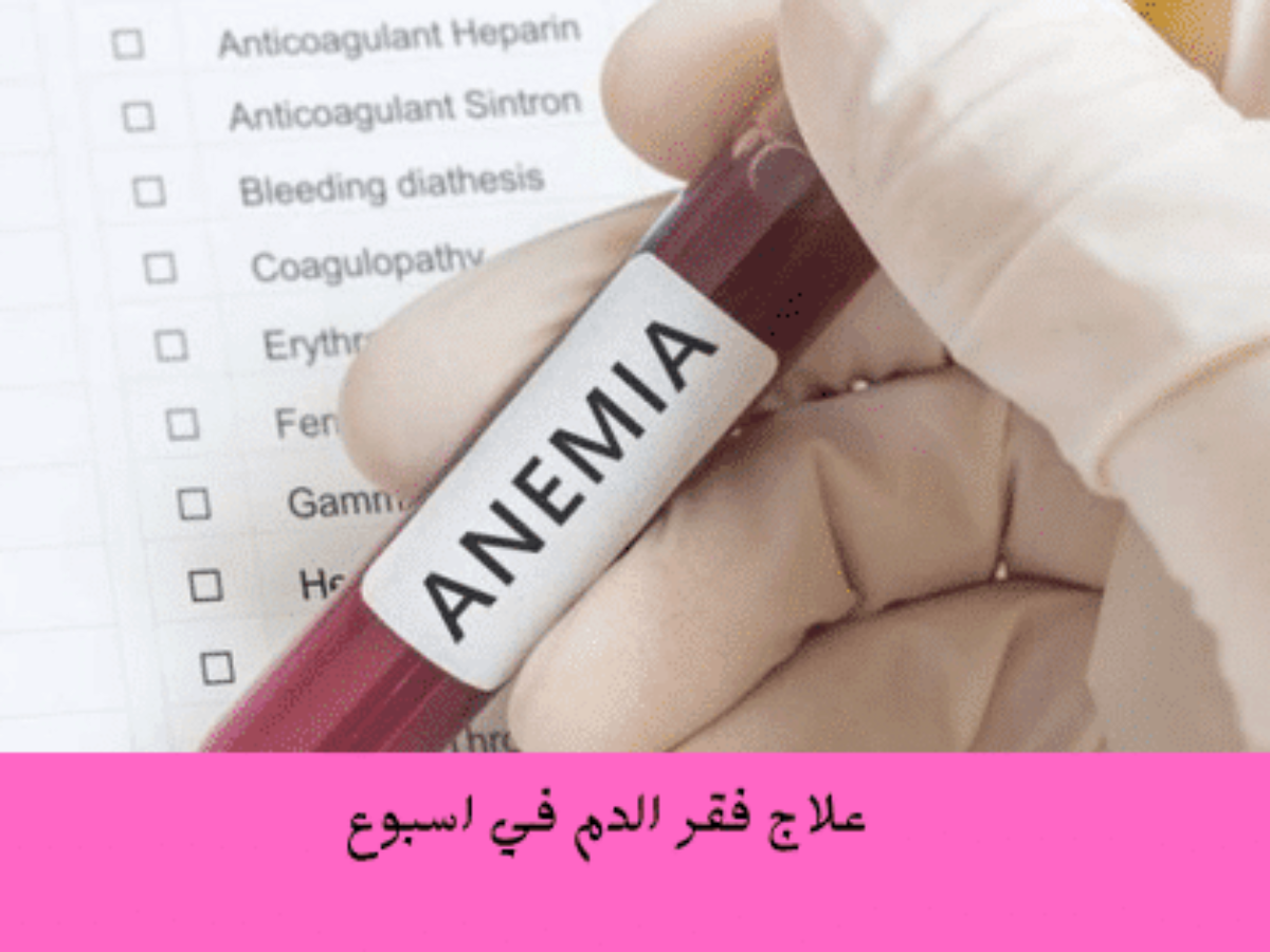 علاج فقر الدم في اسبوع Treatment Of Anemia In A Week برو سايتي