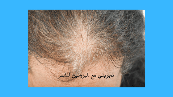 مين جربت فرد البروتين