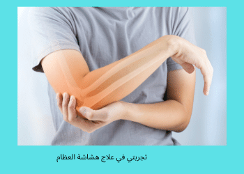 علاج هشاشة العظام